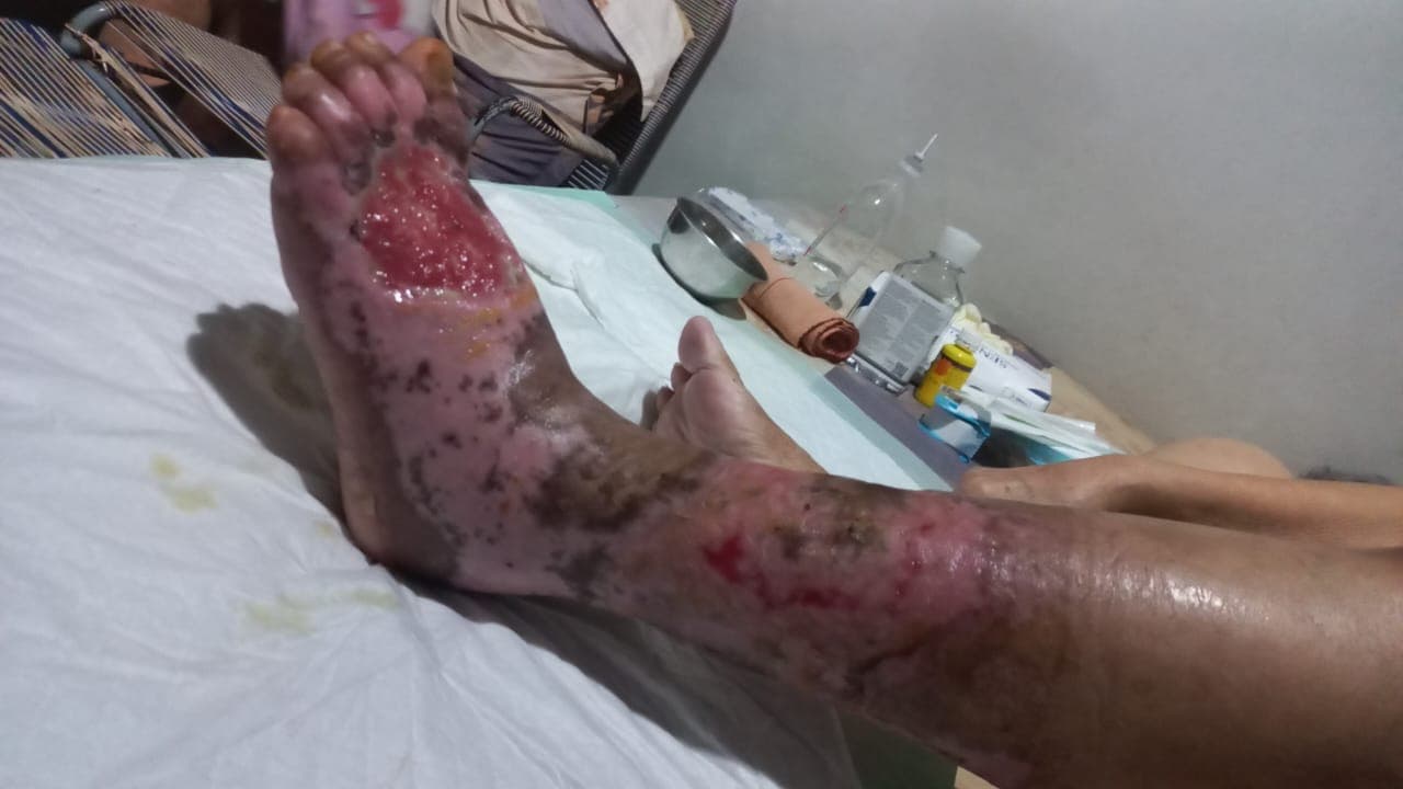 15 Juli