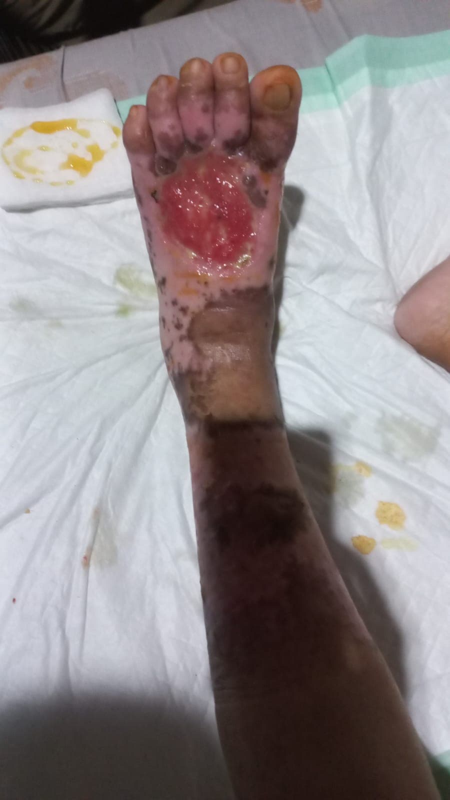 17 Juli
