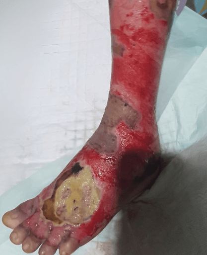 Before Treatment 3